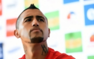 Portal 180 - Vidal sobre humorista uruguayo: “de frente no fue capaz de decírmelo”