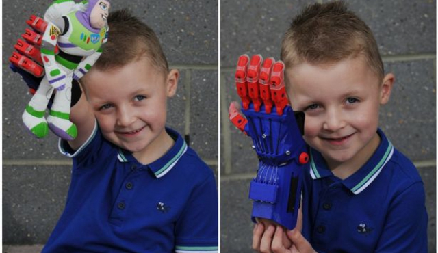 Una prótesis de mano impresa en 3D por 200 euros