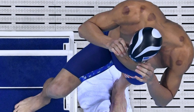 Las manchas por el “cupping” de Phelps, un orgullo para China
