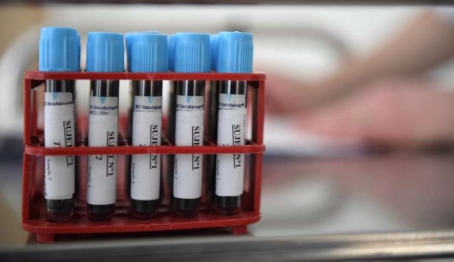 Nueva prueba de sangre puede ayudar en detección temprana de cáncer de páncreas