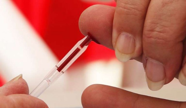 “El paciente de Londres”, segundo caso de remisión del virus del sida