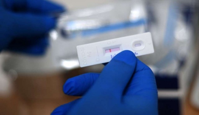 Cómo son los test de antígenos, ahora obligatorios en casos sintomáticos