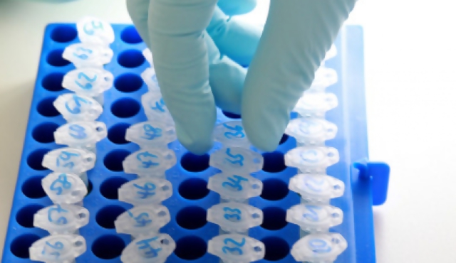 Tuberculosis, enfermedad de pobres