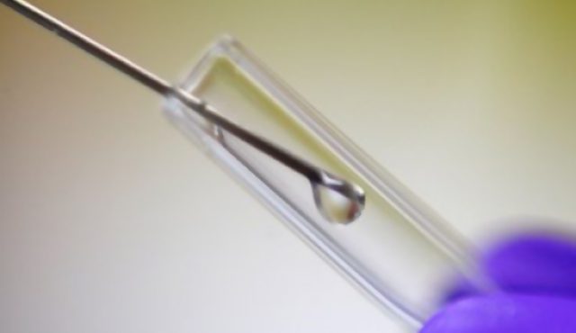 Terapia génica para el cáncer de mama
