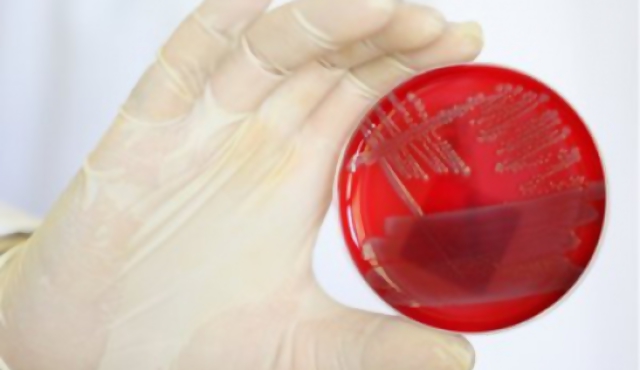 La reivindicación de las bacterias 