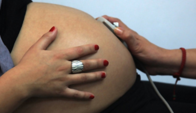 Uruguay vive una "epidemia" de cesáreas