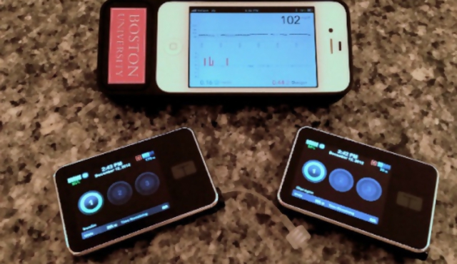 "Páncreas biónico" hecho con un iPhone combate la diabetes